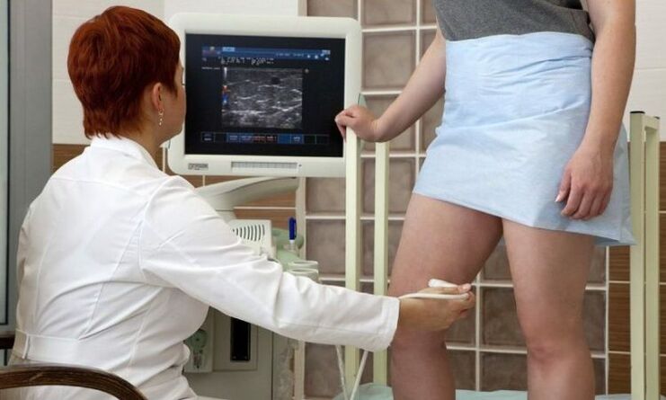 Koagulace laseru pro léčbu křečových žil