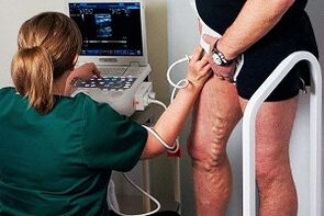 Diagnostické možnosti pro křečové žíly na nohou