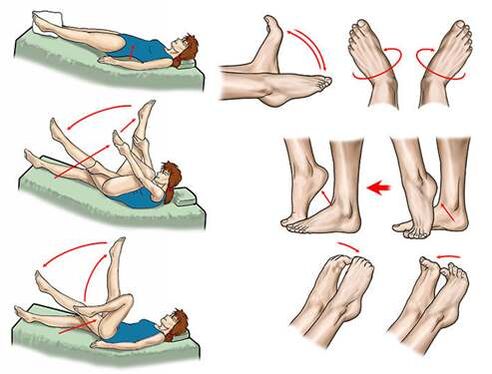 metody léčby křečových žil pánve