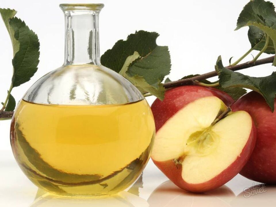 jablečný ocet na křečové žíly